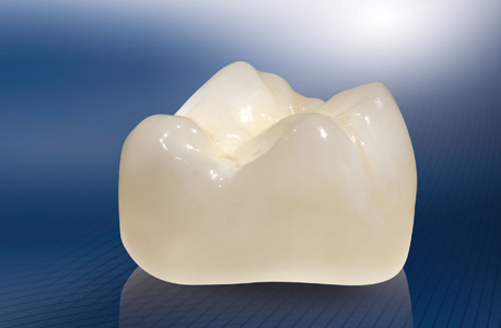 Prothetik Zahnersatz - eine schöne Zahnkrone