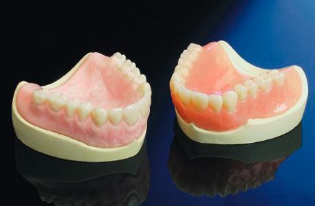 Prothetik Zahnersatz - Bild einer Vollprothese